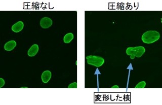 ポーラ、皮膚の老化を招く細胞核の変形を防ぐのはボタンエキスなど