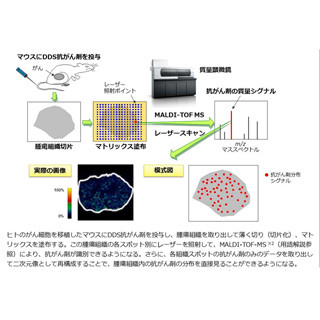 国立がん研、質量顕微鏡によるDDS抗がん剤のイメージングに成功