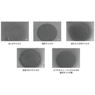 理研、"どんな感染症に免疫があるのか"を15分で診断できるシステムを開発