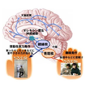 金沢大、ナルコレプシーの症状を抑制できる神経メカニズムを解明