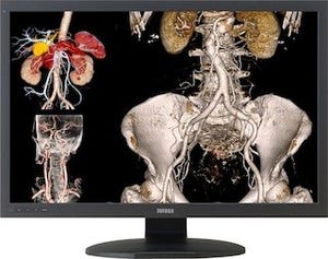 JVCケンウッド、600万画素対応30型カラー医用画像表示用ディスプレイを発表