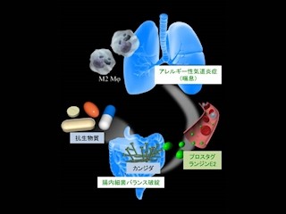 筑波大など、抗生物質が逆にぜん息を悪化させる仕組みを解明