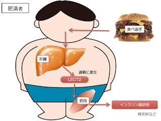 なぜ肥満になると糖尿病を発症しやすいのか? - 金沢大が仕組みの一部を解明