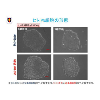 慶応大と味の素、iPS細胞の低コスト生産を可能とする培養液技術を開発