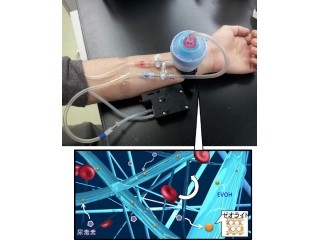 携帯型透析システムへ道 -NIMS、尿毒素を選択的に除去できるデバイスを開発