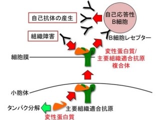 阪大など、自己免疫疾患の発症に関与する自己抗体の仕組みを究明