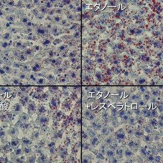 ポリフェノールにアルコール摂取による脂肪肝を緩和させる可能性 - 東大