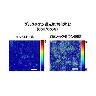 なぜ、がん細胞は抗がん剤耐性を持つようになるのか? - 慶応大が機構を解明