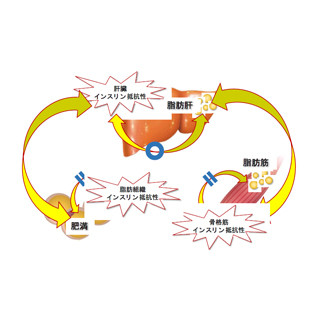 脂肪肝がメタボ化の司令を出している?-金沢大が脂肪肝とメタボの関連を解明