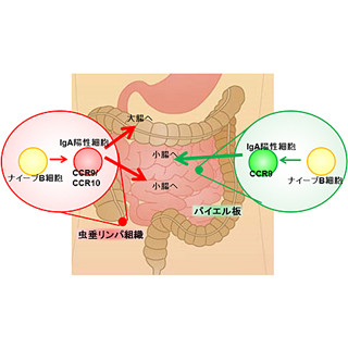 虫垂は無用の長物ではなく、IgA産生の制御に関与していた - 阪大が解明