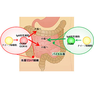 虫垂は無用の長物にあらず、免疫に重要