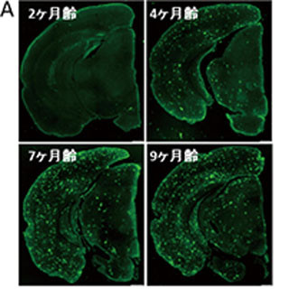理研、従来よりヒト患者に近い病理のアルツハイマー病モデルマウスを開発