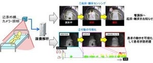 富士通研、看護業務を軽減するカメラによる患者の状態認識技術を開発