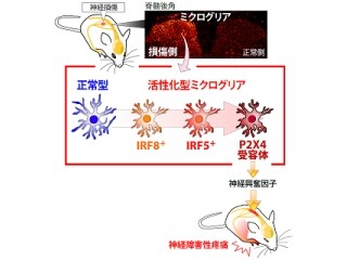 九大など、慢性疼痛の原因タンパク質が「IRF5」であることを究明