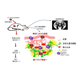 阪大、脳マラリアの新たな診断と治療のターゲットを発見