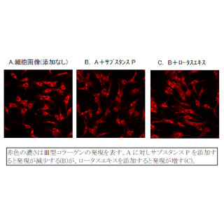 心理ストレスが肌の弾力性低下やくすみの原因!? - ポーラ化成が確認