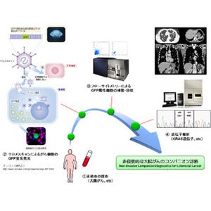  岡山大、血中がん細胞の遺伝子変異を高感度に検出できる技術を開発