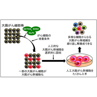 iPS細胞誘導技術を用いて人工大腸がん幹細胞を作製 - 京大と神戸大