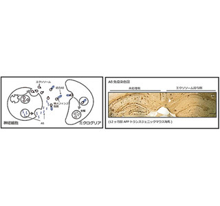 エクソソームでアルツハイマー病抑制か