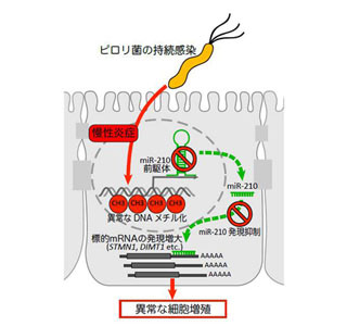 ピロリ菌の胃がん発症原因の一端発見