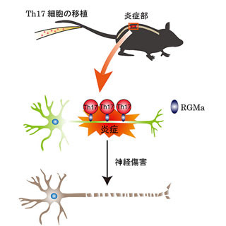 大阪大など、多発性硬化症で神経を傷つける細胞と分子を特定