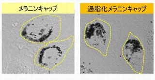 ポーラ化成、頑固なシミ「過脂化メラニンキャップ」 の解決策を開発