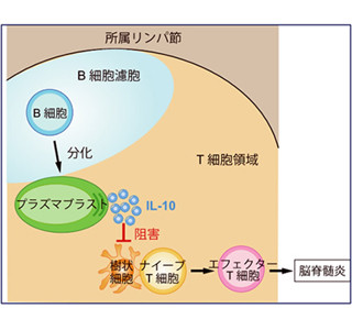 多発性硬化症の悪化を抑える免疫機構解明