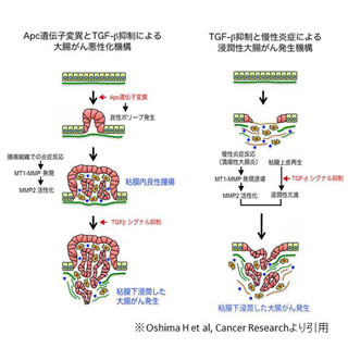 慢性炎症を抑えることでがんの悪性化を制御できる可能性 - 金沢大