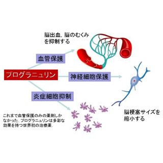 新潟大、脳梗塞に対する画期的治療薬を開発