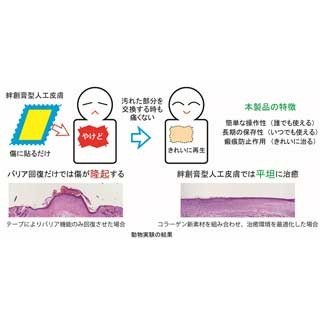 生物研、簡単に使えて治癒後の瘢痕化も抑制する絆創膏型人工皮膚を開発