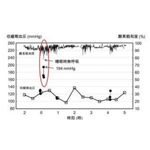 睡眠時無呼吸に伴い血圧が異常上昇するタイプの高血圧を確認-オムロンなど