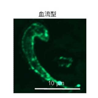 エリンギに「眠り病」治療に応用可能なタンパク質が存在 - 理研