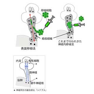 従来の考え方を覆す新たな細胞移植法で聴神経の再生に成功 - 京大