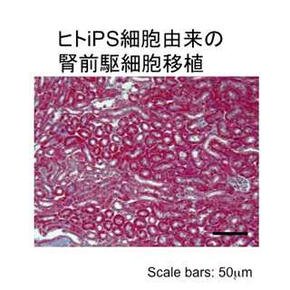 急性腎障害に対するヒトiPS細胞由来の腎前駆細胞の治療効果を確認 - 京大