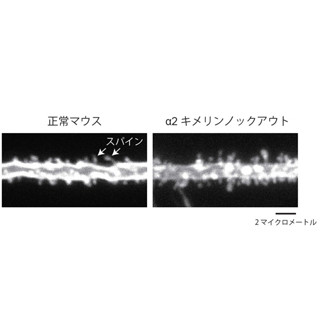 遺伝研など、成長後の記憶能力を制御するタンパク質を発見