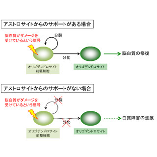 ハーバード大、損傷した脳白質を修復する新たなメカニズムを解明