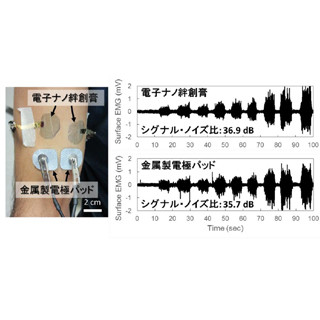 早大、筋肉の活動を計測できる電子ナノ絆創膏を開発