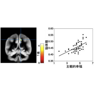 幸福を感じやすい人は特定の脳領域が大きい - 京大