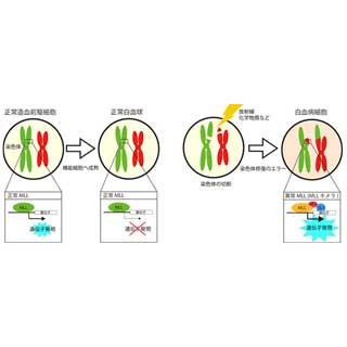 京大、難治性白血病の発症メカニズムを解明 - 治療薬開発に光