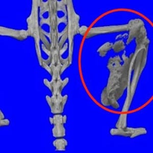 京大CiRA、筋肉などに骨が形成される希少難病の新たな発症メカニズムを発見