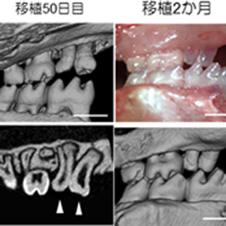 理研と東京医科歯科大、歯胚の分割操作で歯の数を増やす技術を開発