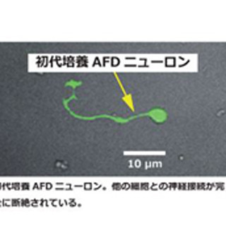 名古屋大、他の細胞との相互作用なしで記憶を形成できる単一神経細胞を発見