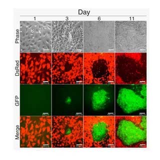 京大、体細胞とiPS細胞の中間にあたるiRS細胞を樹立 - 遺伝子改変が容易に