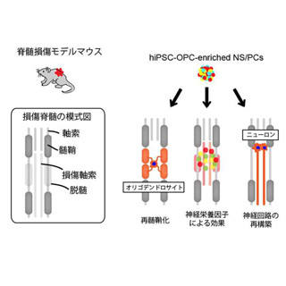 慶大、ヒトiPS細胞由来神経幹細胞を用いて脊髄損傷マウスの運動機能を回復