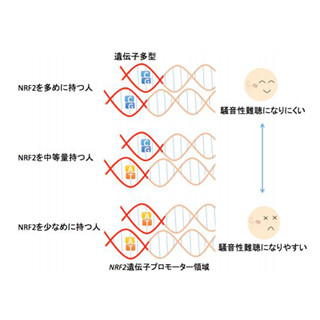 東北大と防衛医大、騒音性難聴には遺伝子「NRF2」の一塩基多型が関与と解明