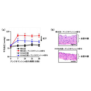 加齢に伴い発現上昇するP2Y6受容体が高血圧リスクを高める - 生理研と九大