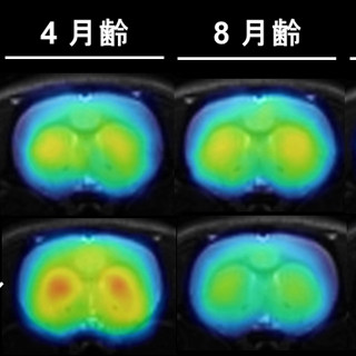 パーキンソン病が進行するとグルタミン酸受容体の発現量が変化 - 放医研