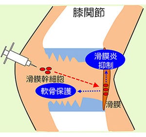 膝関節症を幹細胞注射で治療 東京医科歯科大がラットで効果実証