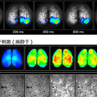 理研など、微弱な電気刺激がマウスの脳機能を活性化させるメカニズムを解明