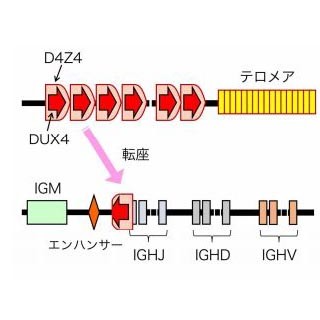 東大、思春期～若年成人の白血病の原因となる新たながん遺伝子を発見